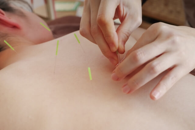 鍼灸