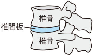 椎間板