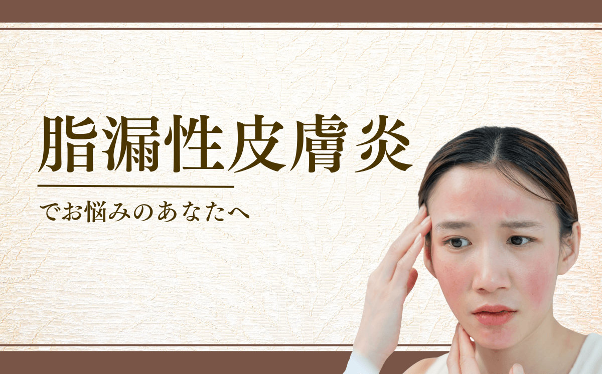 脂漏性皮膚炎