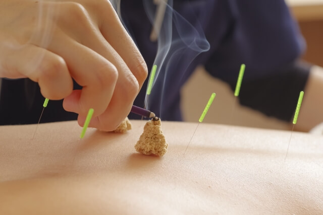 お灸施術
