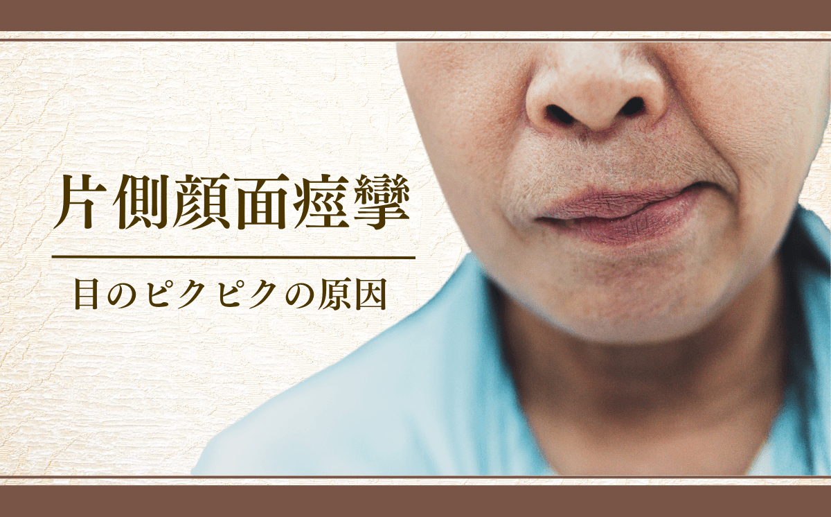 片側顔面痙攣